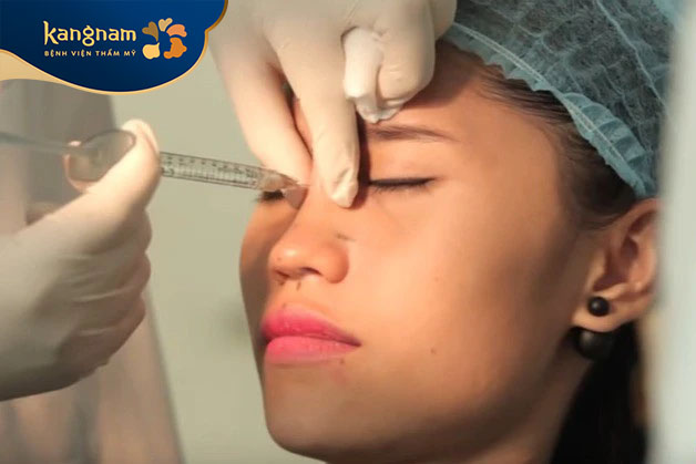 Tiêm filler mũi  là một trong những phương pháp nâng mũi không phẫu thuật