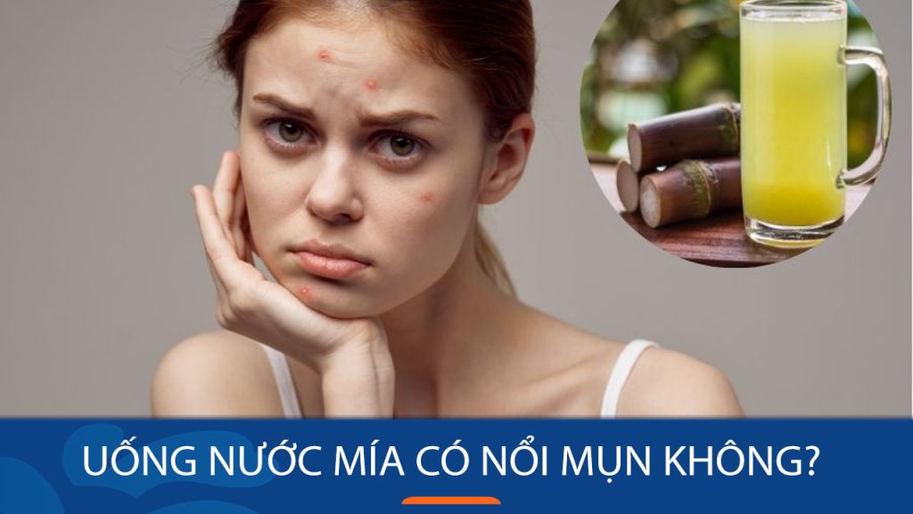 Uống nước mía có thực sự gây mụn? Giải đáp chuyên gia