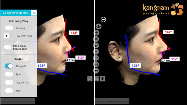 Công nghệ AI-Face Design giúp khách hàng xem trước kết quả nâng mũi