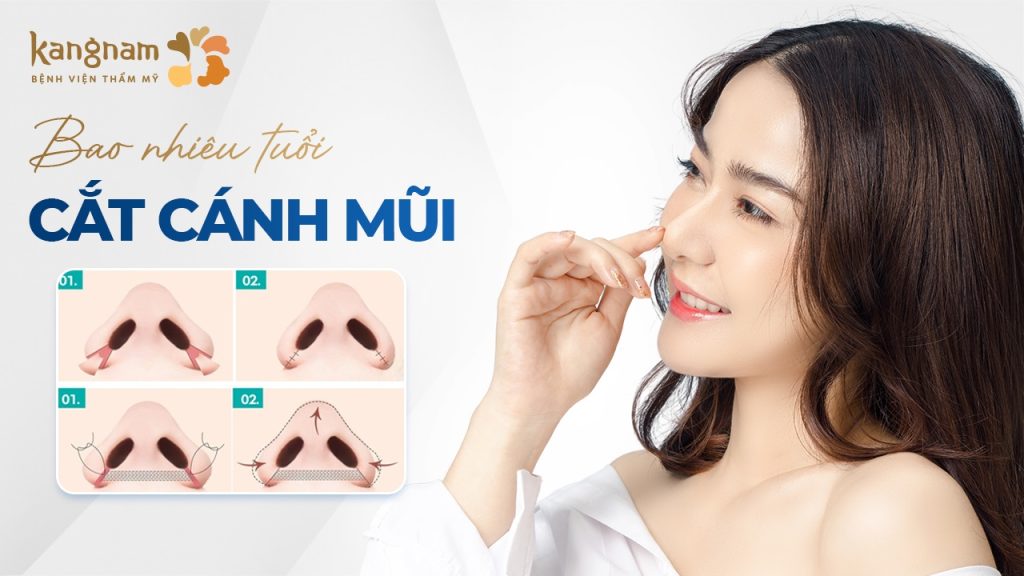 Bao nhiêu tuổi được cắt cánh mũi? Giải đáp mọi thắc mắc