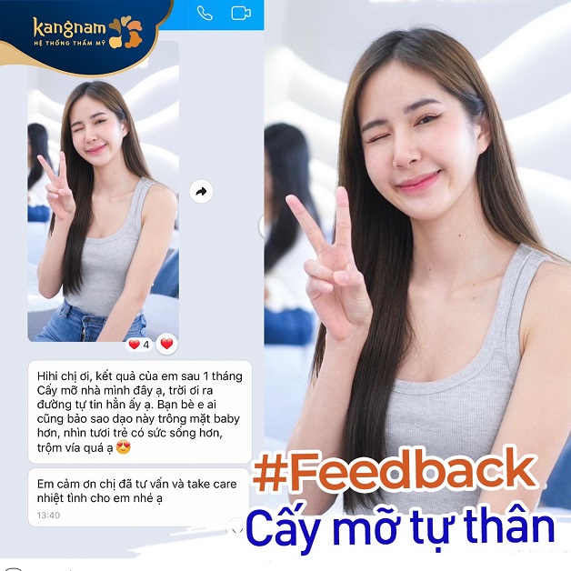 Feedback của khách hàng sau khi thực hiện cấy mỡ tự thân tại Kangnam