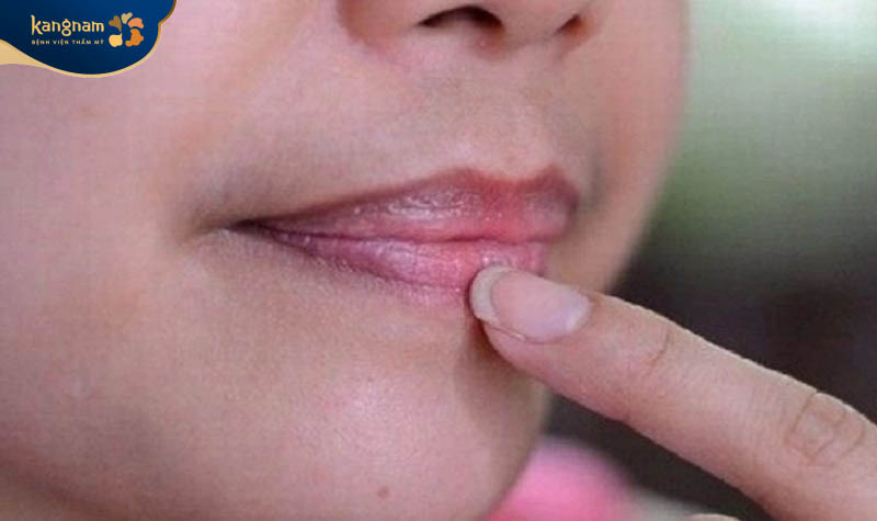 Môi bị thâm do sử dụng mực phun kém chất lượng