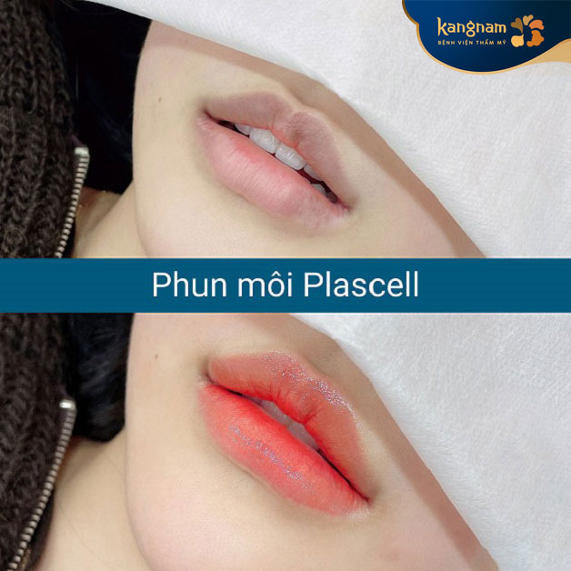 Công nghệ phun môi Plascell duy trì màu môi bền theo thời gian