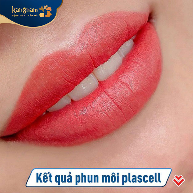 Phun môi plascell giúp môi mềm mịn, tươi tắn hơn