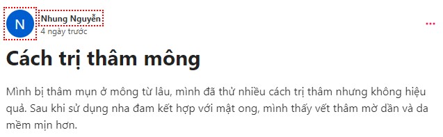 Bạn Nguyễn Nhung thấy các vết thâm mờ dần sau một thời gian dùng nha đam kết hợp với mật ong