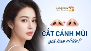 Cắt cánh mũi giá bao nhiêu? Bảng giá cập nhật mới nhất 2024