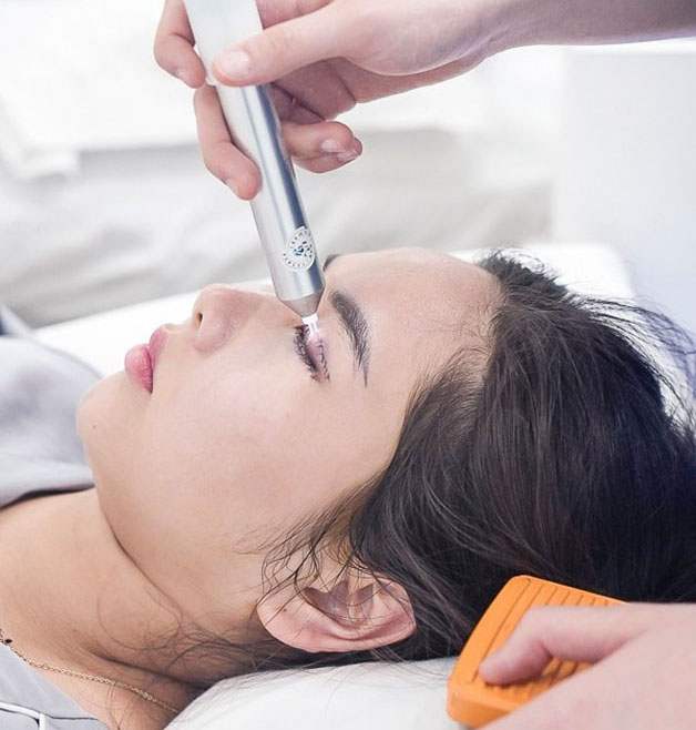 Chiếu tia plasma lạnh giảm sưng nề