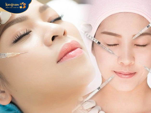 Sau sinh con 6 tháng có thể tiêm filler