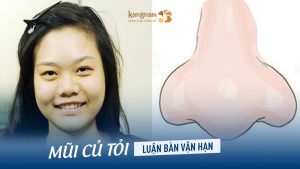 Mũi Củ Tỏi: Luận bàn Vận Hạn, Ý nghĩa cuộc đời theo Phong Thủy