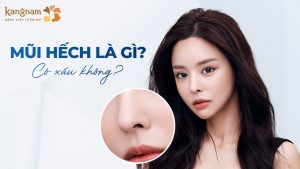 Mũi Hếch là gì? Có xấu không? Vận mệnh Nam, Nữ thế nào?