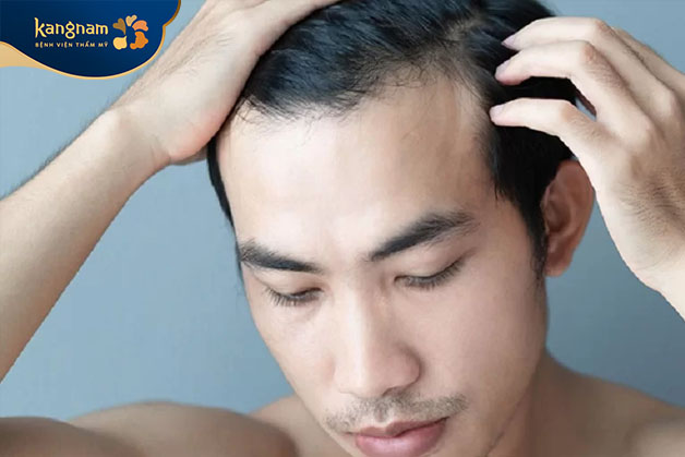 Nam giới trán cao thường có tính cách điềm tĩnh