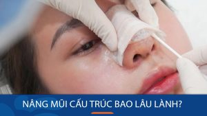 Nâng mũi cấu trúc bao lâu lành? Hướng dẫn chi tiết từ A đến Z