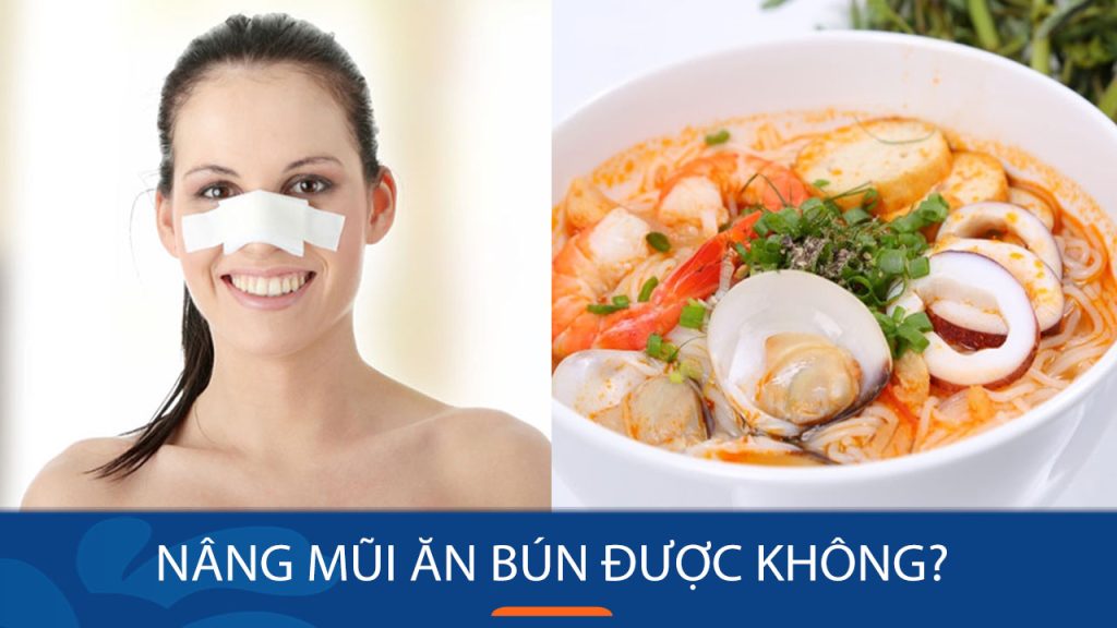 Nâng mũi ăn bún được không? Giải đáp từ chuyên gia HENRY NGUYỄN