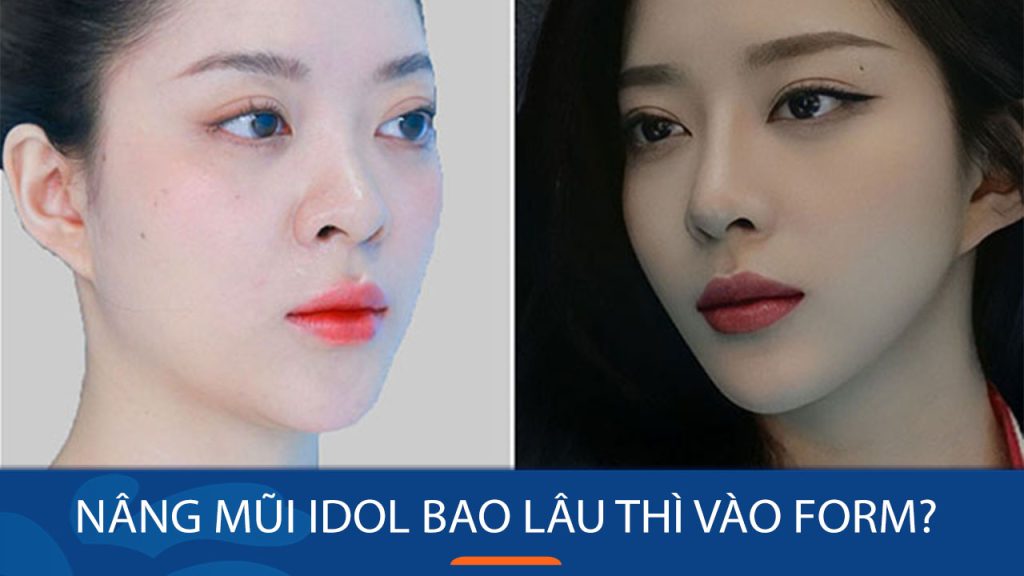 Nâng mũi Idol bao lâu vào khuôn? Giải đáp thắc mắc từ chuyên gia