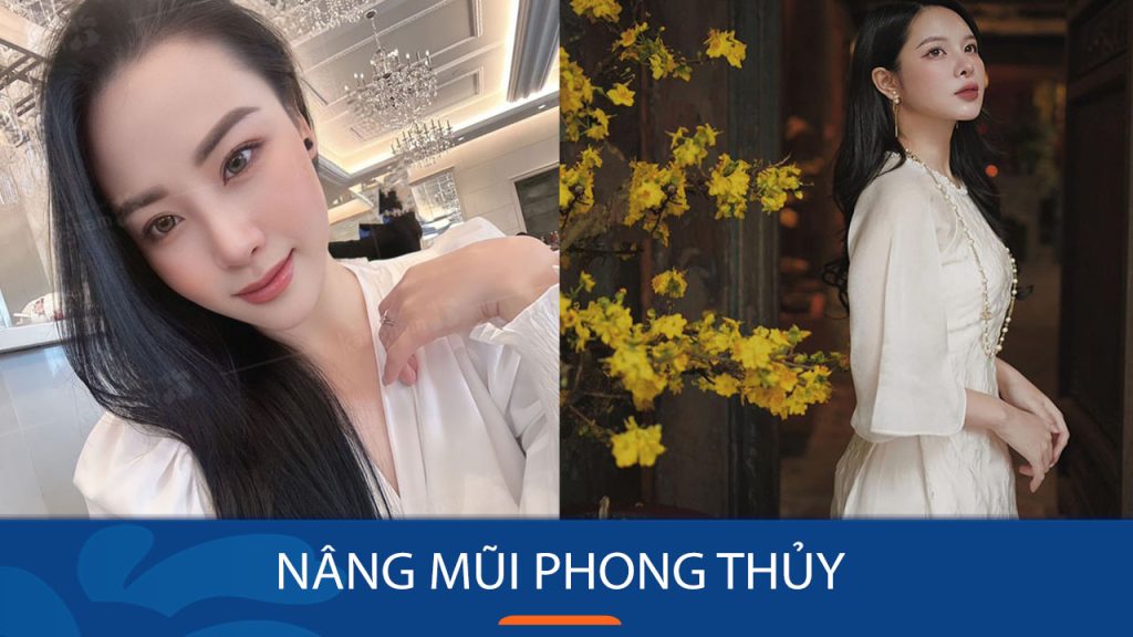 Nâng mũi phong thủy: Bí quyết cải thiện vận mệnh và tài lộc