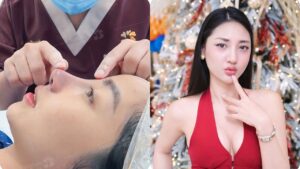 Nâng mũi phong thủy