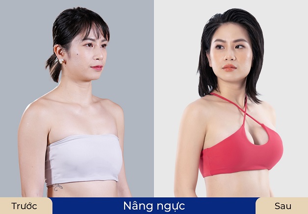 Khách hàng Fankie hài lòng với bầu 1 săn chắc, quyến rũ