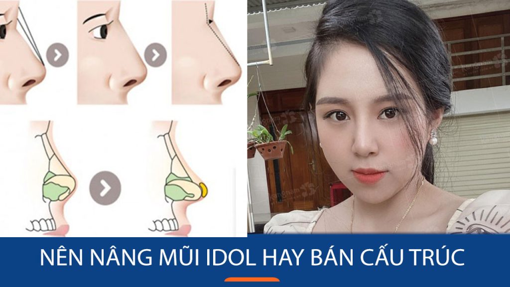 Nâng mũi Idol hay Bán cấu trúc: Nên chọn phương pháp nào?