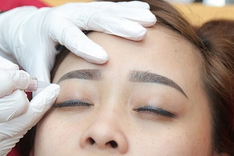 Kỹ thuật phun mí cũ, màu mực trổ xanh khiến gương mặt bị già
