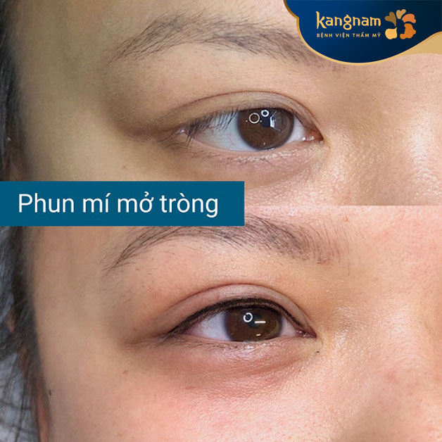 Phun mí tự nhiên