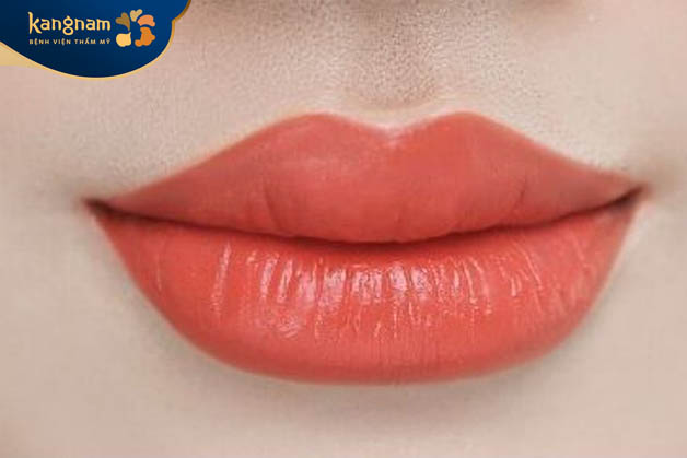 Màu môi sau khi phun có thể duy trì ổn định từ 3 – 5 năm