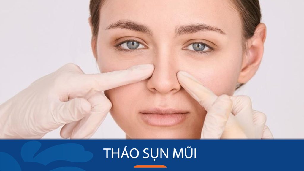 Nên tháo sụn mũi hay không? 6 dấu hiệu cho thấy bạn cần tháo sụn mũi