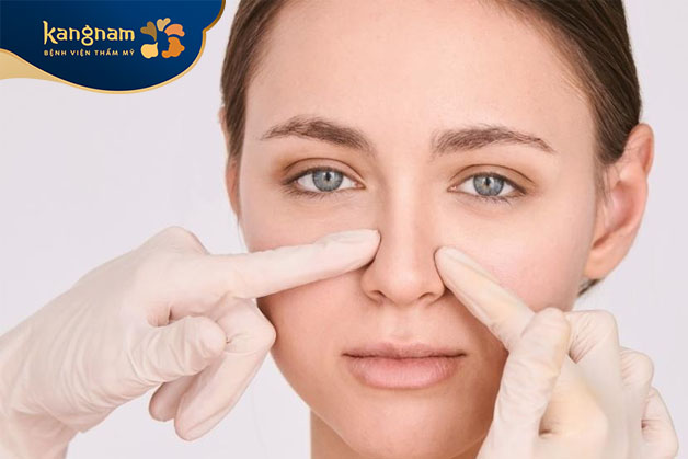 Tỷ lệ mũi trở về hình dáng bình thường như ban đầu vào khoảng 80 - 90% sau khi tháo sụn