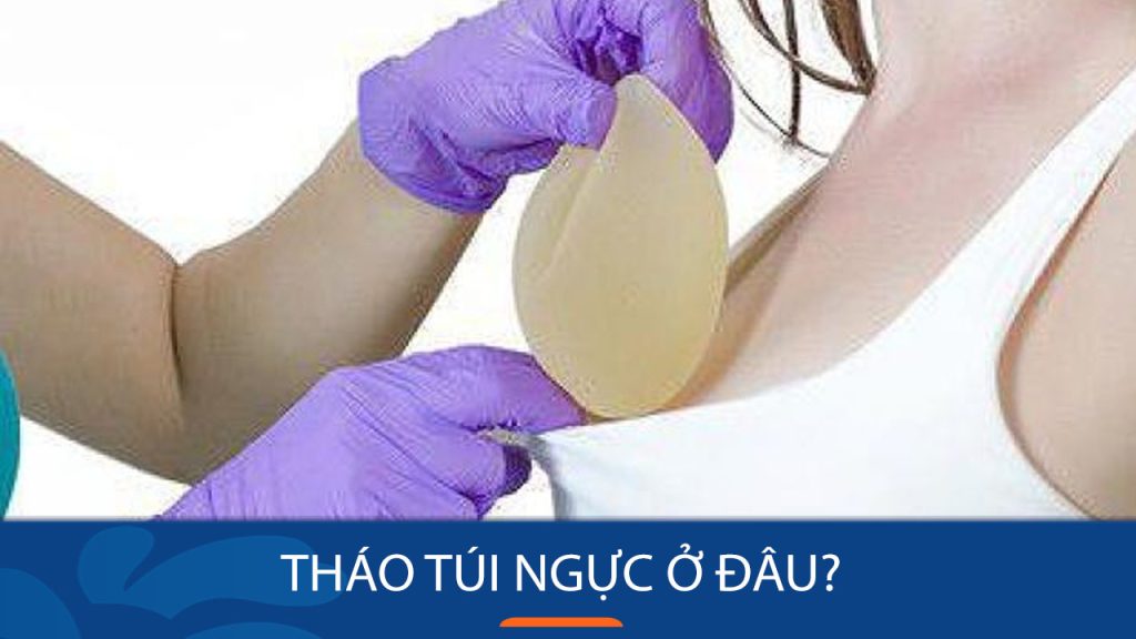 Tháo túi ngực ở đâu an toàn? Cách lựa chọn địa chỉ uy tín