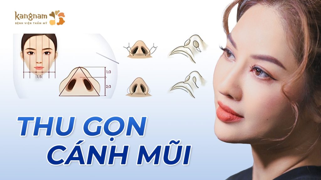 Thu gọn cánh mũi chỉ sau 30 phút, không để lại sẹo