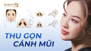 Thu gọn cánh mũi – Bí quyết sở hữu dáng mũi thon gọn hoàn hảo