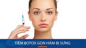 Tiêm Botox Gọn Hàm Bị Sưng: Bình Thường Hay Dấu Hiệu Biến Chứng?