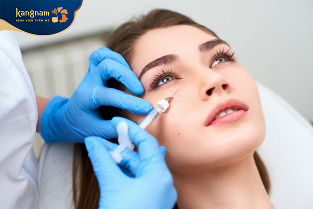 Tiêm filler xóa rãnh lệ là phương pháp thẩm mỹ không phẫu thuật