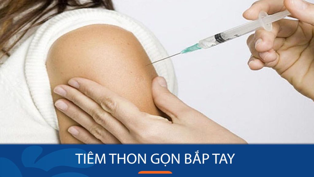 Tiêm thon gọn bắp tay là gì? Giữ được bao lâu