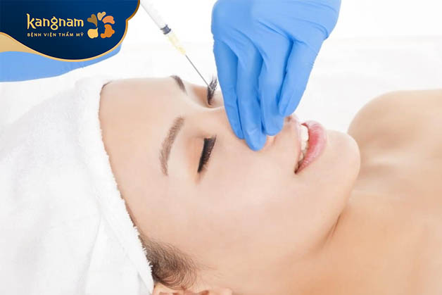 Quá trình tiêm botox vào mô mũi thường diễn ra trong khoảng 15-30 phút