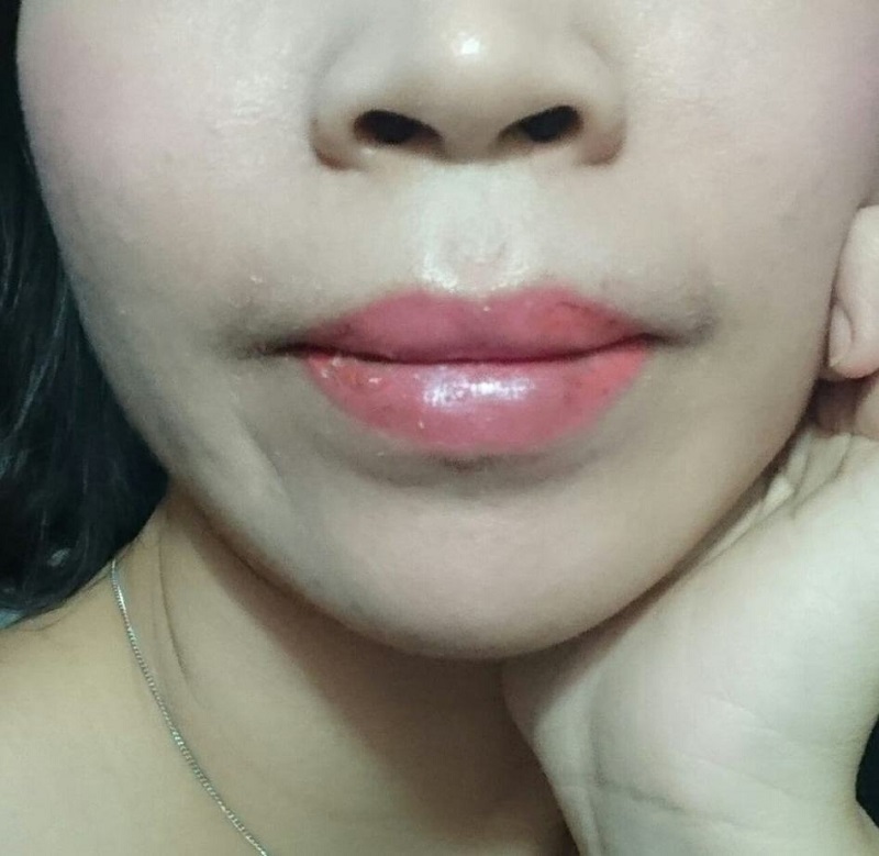 Việc uống nước dừa quá sớm sẽ khiến môi bị loang lổ, lên màu không đều