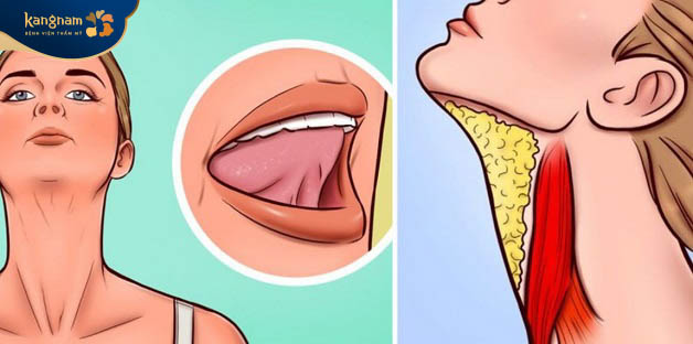 Tập đẩy lưỡi để giảm mỡ thừa