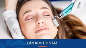 Lăn kim trị nám có hại không? Giải đáp từ Bác sĩ da liễu