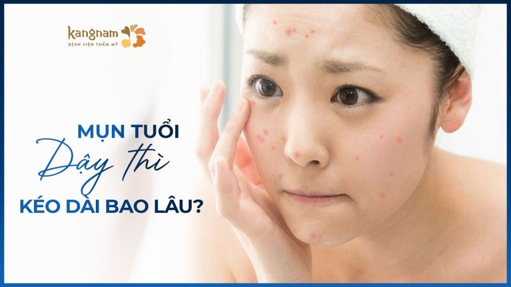 Mụn tuổi dậy thì kéo dài bao lâu? Cách trị mụn ở tuổi dậy thì