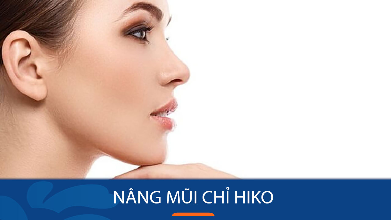 Nâng mũi chỉ Hiko là gì?- Giải pháp thẩm mỹ không phẩu thuật