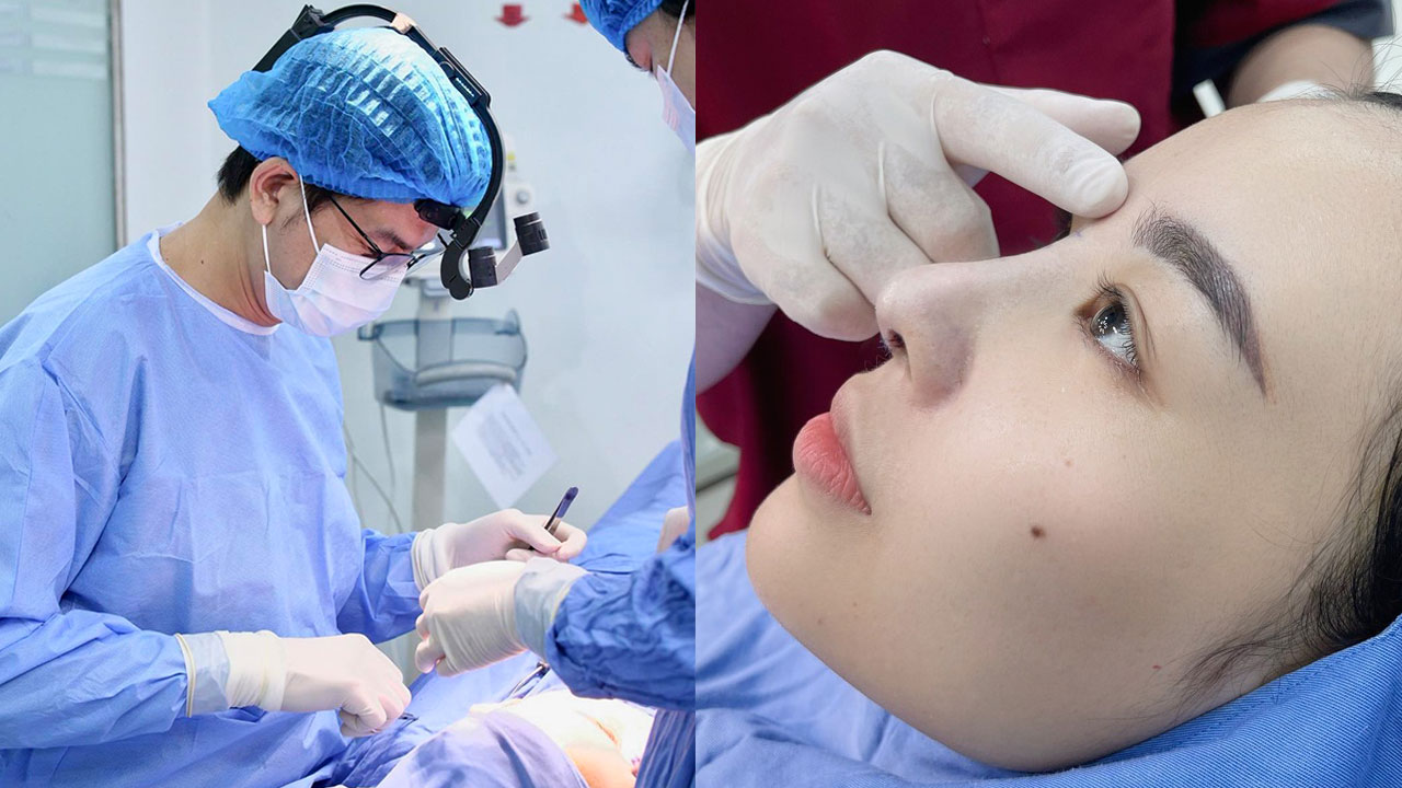 Bác sĩ Henry Nguyễn giải đáp 5 câu hỏi thường gặp về phẫu thuật nâng mũi