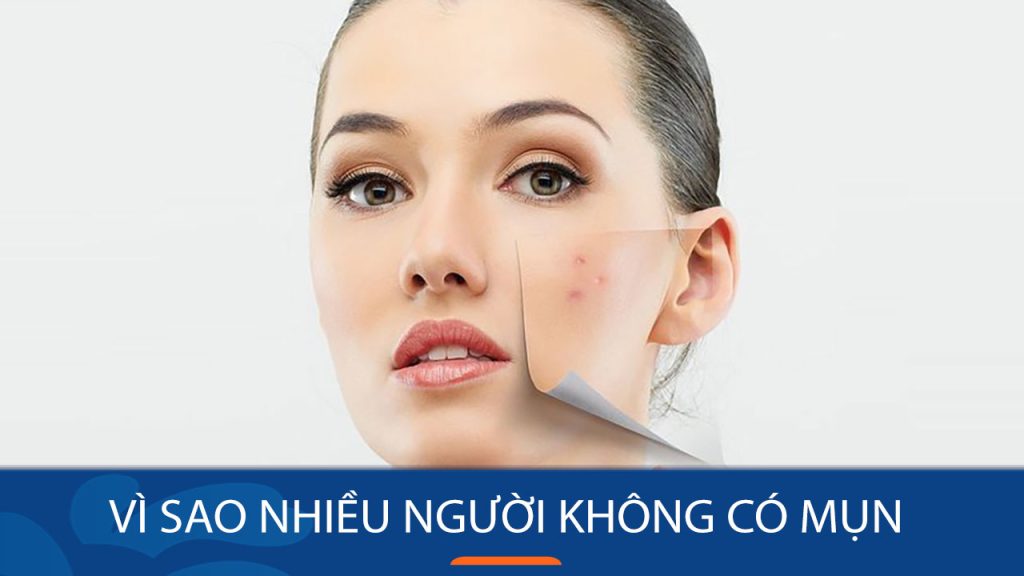 Vì sao nhiều người không có mụn? Bí quyết sở hữu làn da mịn màng, căng bóng