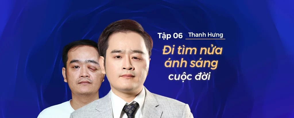 Hành Trình Lột Xác mùa 6 | Tập 6: Thanh Hưng – Chàng trai u mắt lột xác