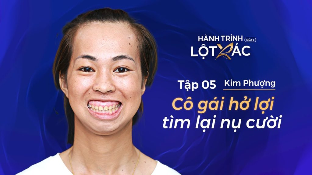 Hành Trình Lột Xác mùa 6 | Tập 5: Kim Phượng – Cô gái “hở lợi” lột xác