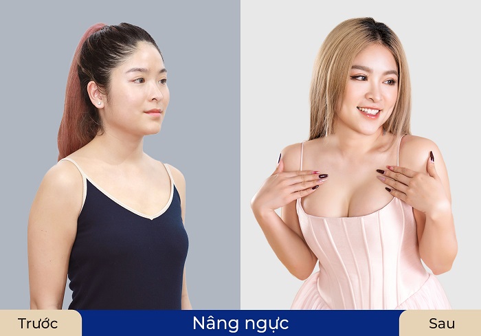 Chị N.T.M.H tự tin hơn với diện mạo mới