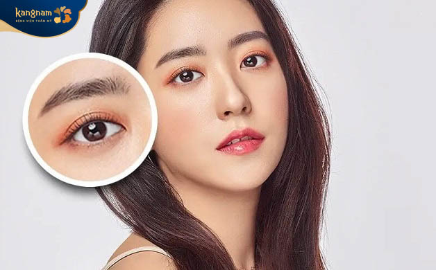 Bấm mí mắt Hàn Quốc cho đôi mắt đẹp quyến rũ