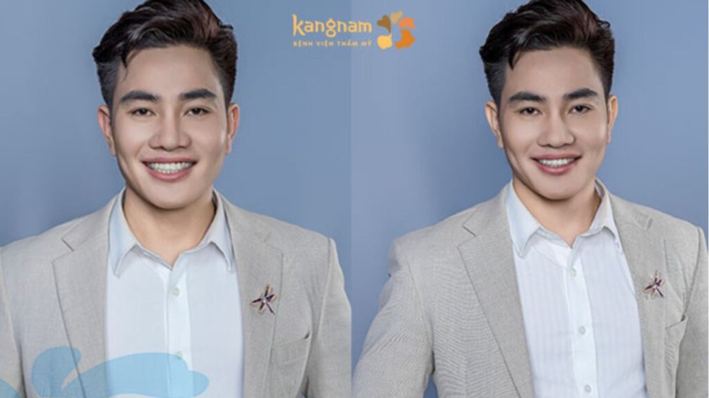 Chàng trai xứ Thanh hóa nam thần sau màn lột xác tại Kangnam Thanh Hóa