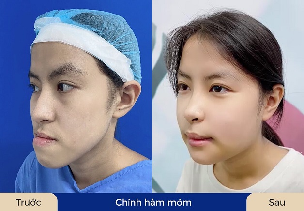 Phản hồi từ khách hàng đã từng thực hiện sẽ giúp bạn có thêm thông tin để lựa chọn