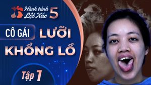 Hành Trình Lột Xác mùa 5 | Tập 1: Trần Thị Thủy – Cô gái lưỡi khổng lồ