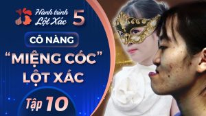 Hành Trình Lột Xác mùa 5 | Tập 10: Đỗ Thị Bình – Cô nàng miệng cóc lột xác