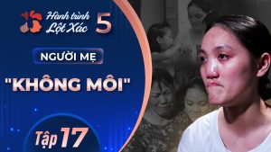 Hành Trình Lột Xác mùa 5 | Tập 17: Nguyễn Thị Hằng – Người mẹ không môi